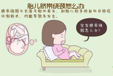 胎儿脐带绕颈一周怎么办孕妈需要知道的几个点