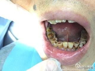 �����°������ݣ���Ȱ��Ҫ�����ƣ�