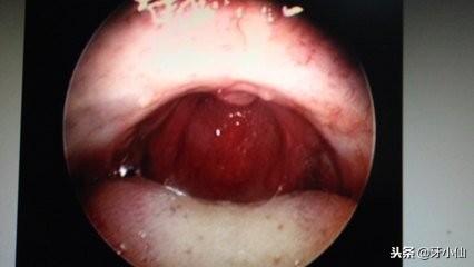 �����°������ݣ���Ȱ��Ҫ�����ƣ�