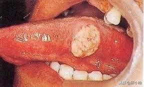 �����°������ݣ���Ȱ��Ҫ�����ƣ�