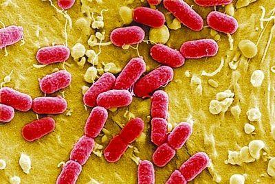 �Ժ��������˶������󳦸˾���Ⱦ��ʲô����������