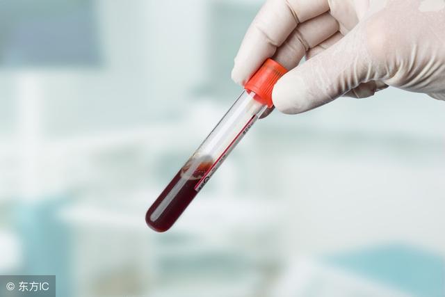 ʲô��Ѫ��֬��ø��Ѫ��֬��øƫ�ߺ�ƫ��������ô���£�