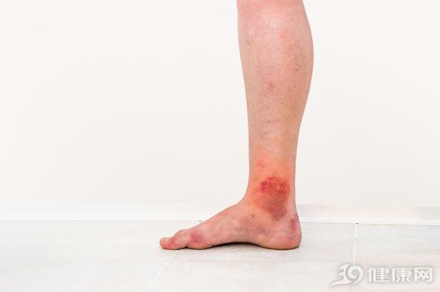 ���챻��涣ҧ����⣬�������Ĵ��������������������