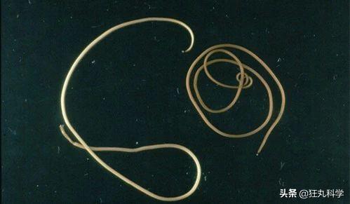 ̨�循��ɥʬ��ţ�������Ѿ���ȫ�ܼ�����ڲ�