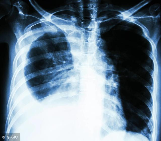 ��������ǻ��Һ����Ĥ������ʲôԭ�������