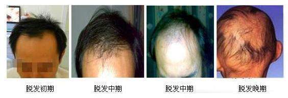 ����ϴ��ˮ���������ĸ����ӵ�Ч���ã�