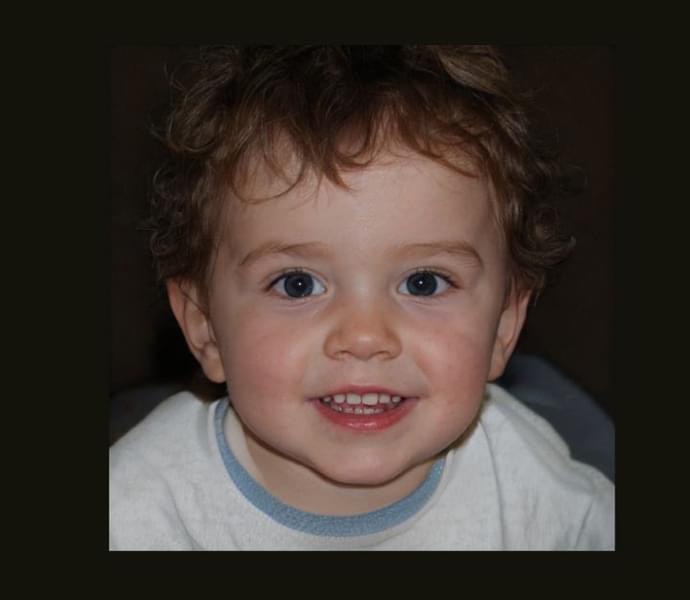 ���˲�����